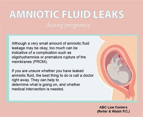 how to know if amniotic fluid is leaking|3 Ways to Identify an Amniotic Fluid Leak